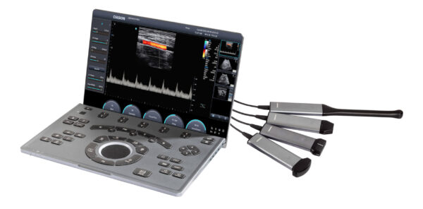 CHISON Sonoair 70