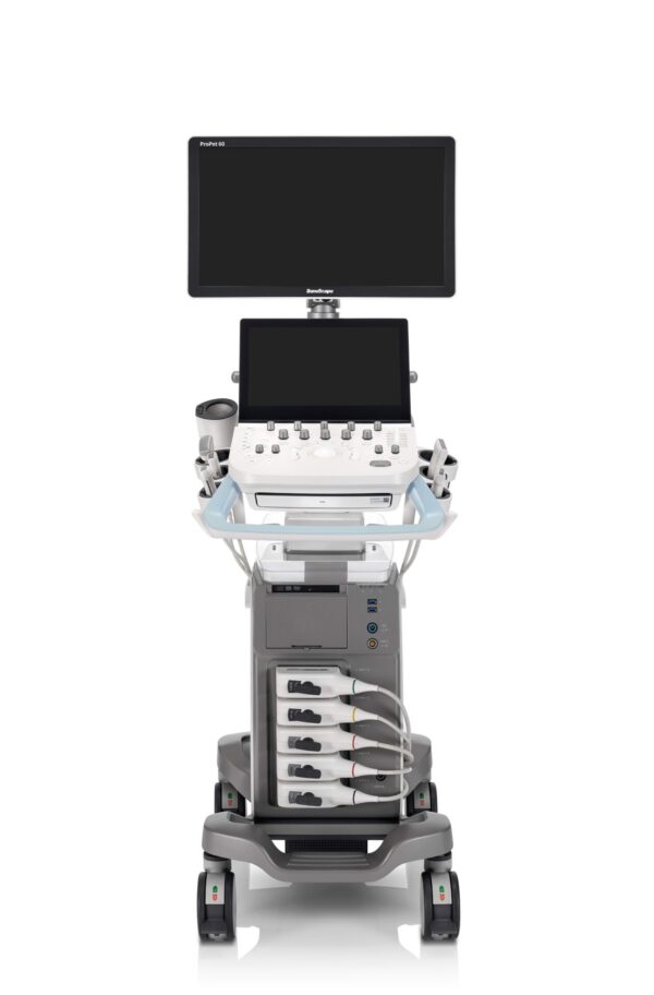 SonoScape ProPet 60