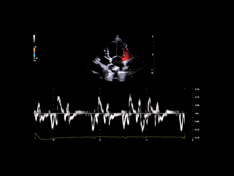 Esaote MyLab Panther clinical image