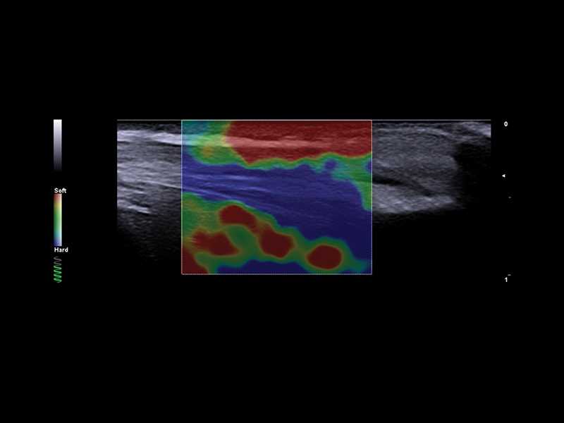 Esaote MyLab Panther clinical image