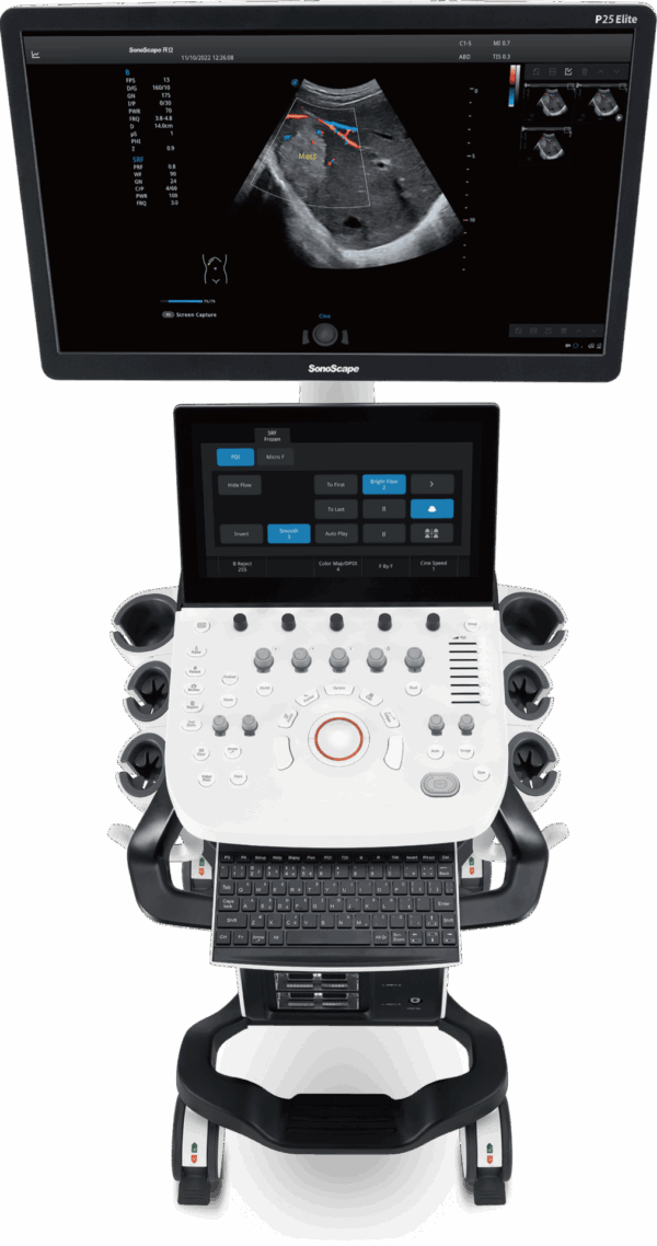 SonoScape P25 Elite