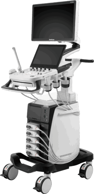 SonoScape P25 Elite