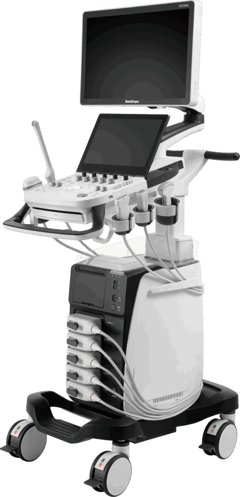 SonoScape P25 Elite