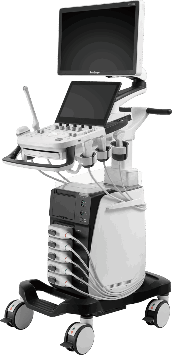 SonoScape P25 Elite