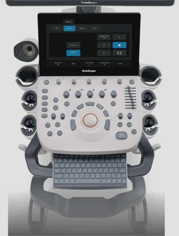 SonoScape P20 Elite