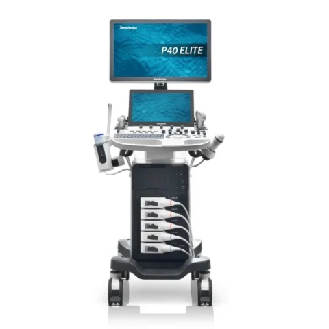 SonoScape P40 Elite