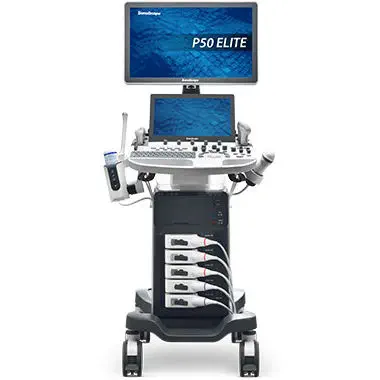 SonoScape P50 Elite