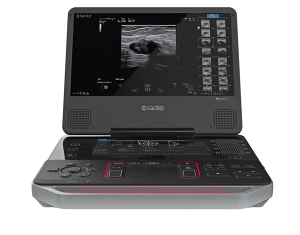 Esaote MyLab C30